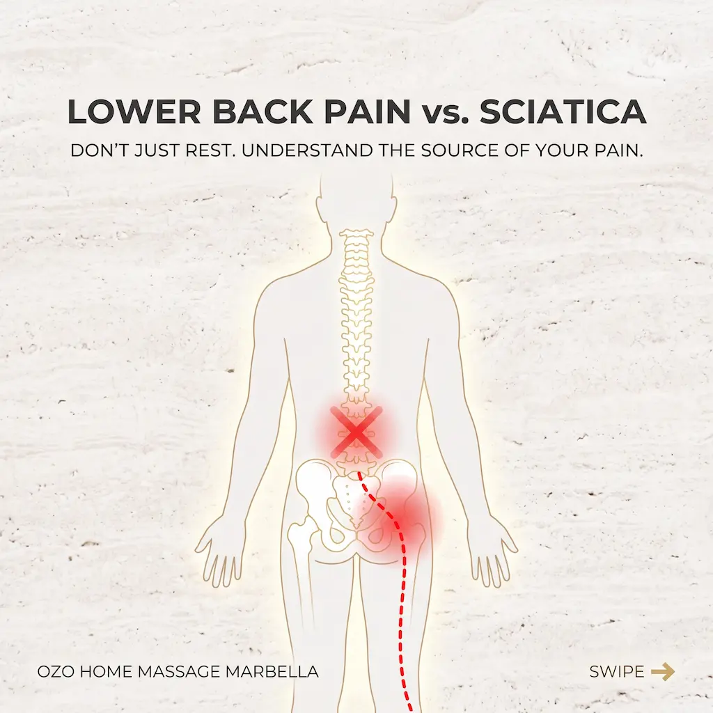 Lower back pain vs sciatica diagnostic illustration by OZO Home Massage Marbella